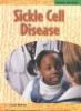 Sickle_cell_disease